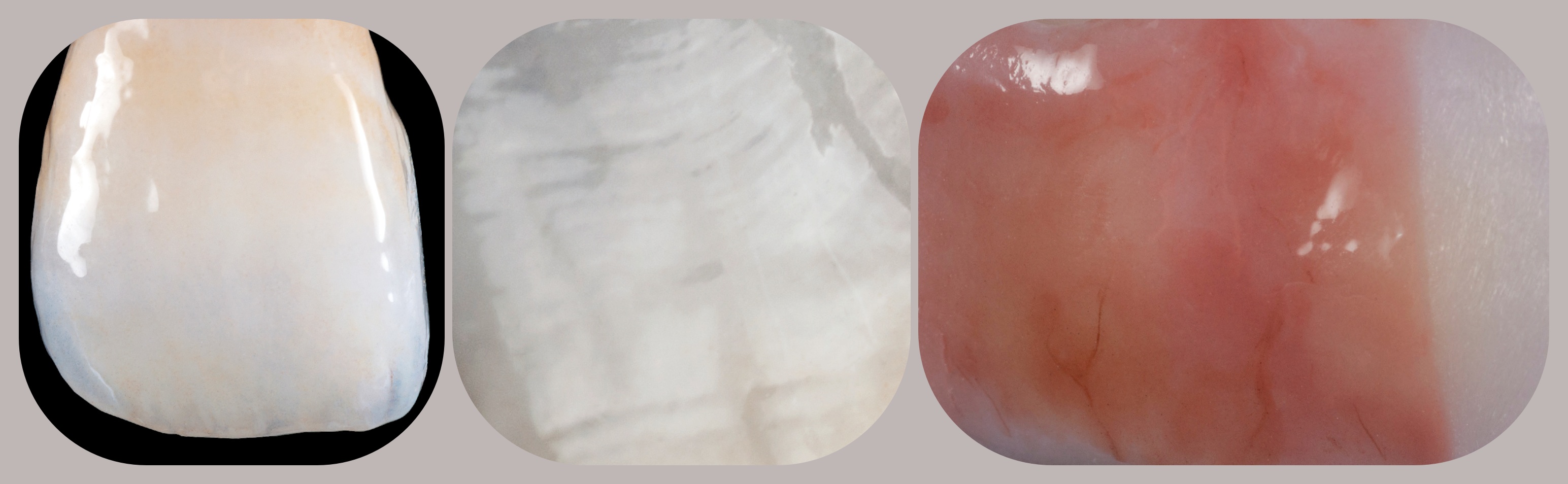 MIYO-ceramica lichida - AGC New Dent
